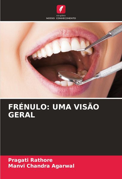 Produktbild: Fr&eacute;nulo: Uma Vis&atilde;o Geral