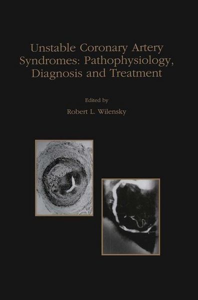 Produktbild: Unstable Coronary Artery Syndromes Pathophysiology, Diagnosis and Treatment