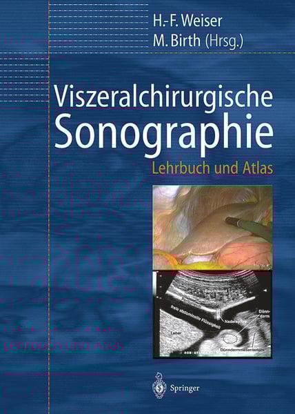 Viszeralchirurgische Sonographie, Taschenbuch von , Springer Berlin, 9783642629587