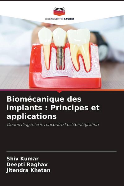 Produktbild: Biom&eacute;canique des implants : Principes et applications