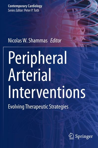 Produktbild: Peripheral Arterial Interventions