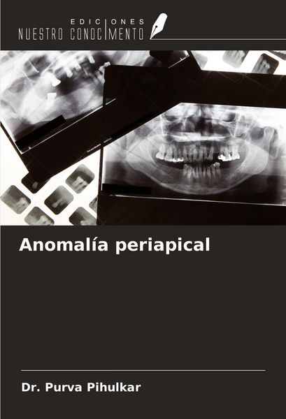 Produktbild: Anomal&iacute;a periapical