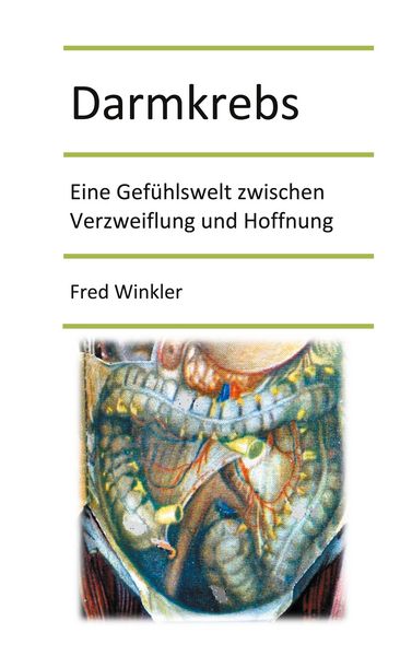 Produktbild: Darmkrebs