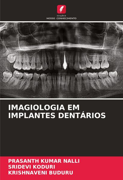 Produktbild: IMAGIOLOGIA EM IMPLANTES DENT&Aacute;RIOS