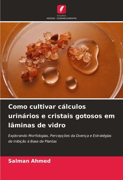 Produktbild: Como cultivar c&aacute;lculos urin&aacute;rios e cristais gotosos em l&acirc;minas de vidro