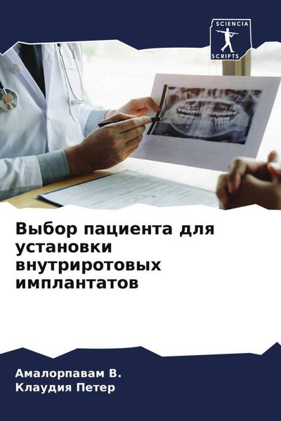 Produktbild: Vybor pacienta dlq ustanowki wnutrirotowyh implantatow
