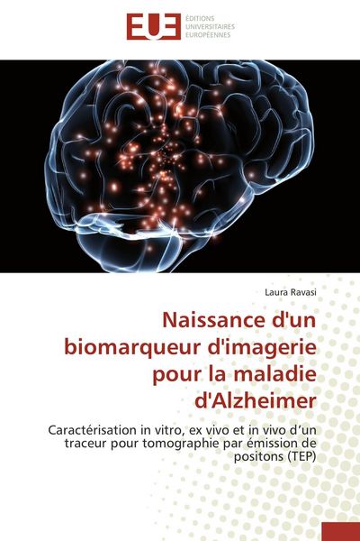 Produktbild: Naissance d'un biomarqueur d'imagerie pour la maladie d'Alzheimer