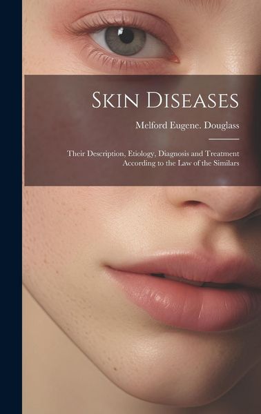 Produktbild: Skin Diseases: Their Description, Etiology, Diagnosis and Treatment According to the Law of the Similars