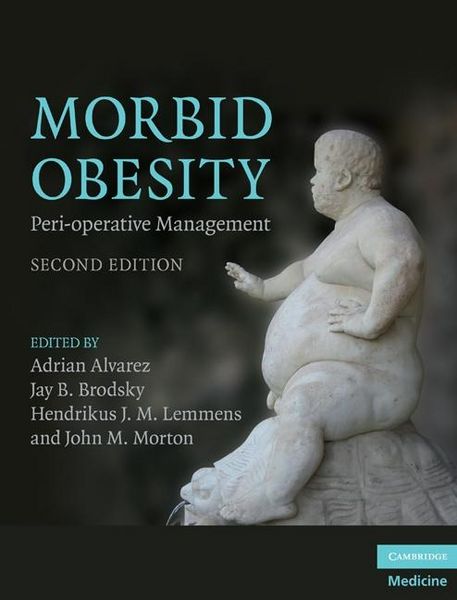 Produktbild: Morbid Obesity