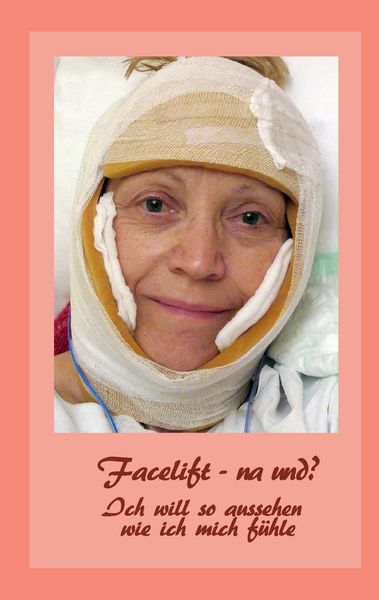 Produktbild: Facelift - na und?