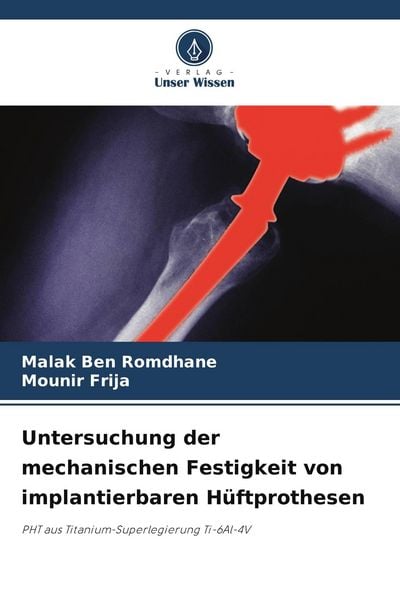Produktbild: Untersuchung der mechanischen Festigkeit von implantierbaren H&uuml;ftprothesen