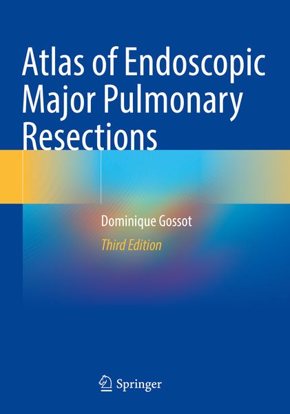 Produktbild: Atlas of Endoscopic Major Pulmonary Resections