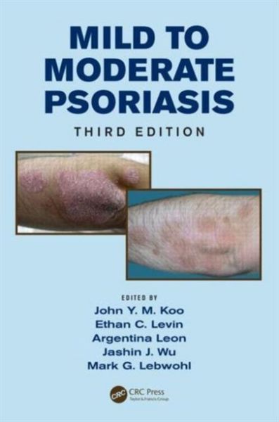 Produktbild: Mild to Moderate Psoriasis