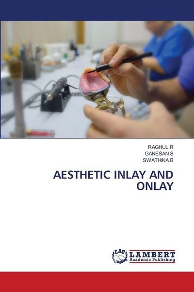 Produktbild: Aesthetic Inlay and Onlay