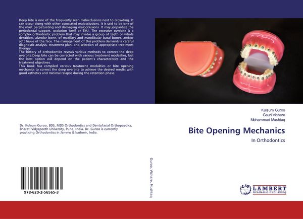 Produktbild: Bite Opening Mechanics