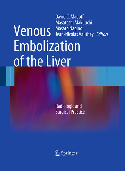 Produktbild: Venous Embolization of the Liver