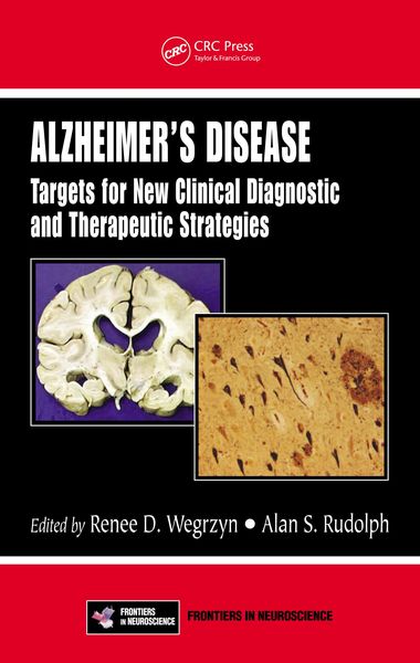 Produktbild: Alzheimer's Disease