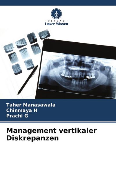 Produktbild: Management vertikaler Diskrepanzen