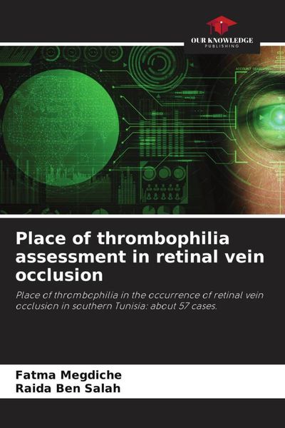 Produktbild: Place of thrombophilia assessment in retinal vein occlusion