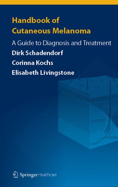 Produktbild: Handbook of Cutaneous Melanoma