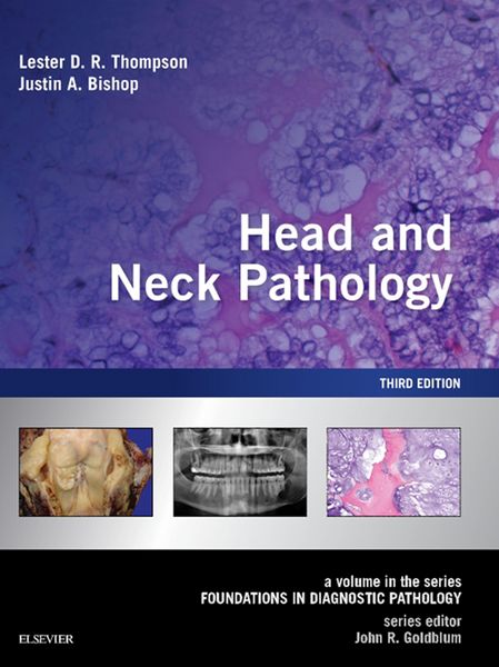 Produktbild: Head and Neck Pathology E-Book