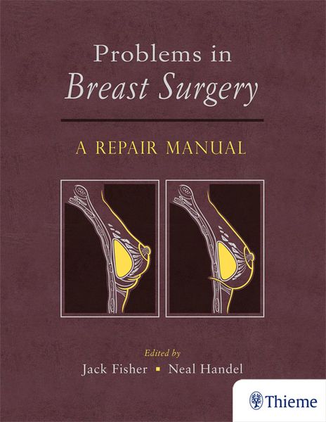 Produktbild: Problems in Breast Surgery