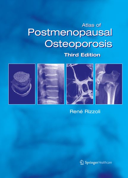 Produktbild: Atlas of Postmenopausal Osteoporosis