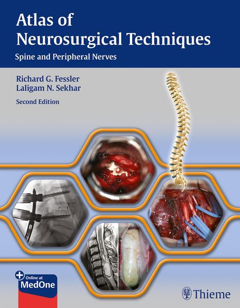 Produktbild: Atlas of Neurosurgical Techniques