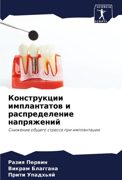 Produktbild: Konstrukcii implantatow i raspredelenie naprqzhenij