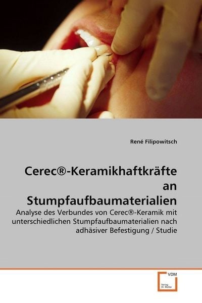 Produktbild: Filipowitsch, R: Cerec&reg;-Keramikhaftkr&auml;fte an Stumpfaufbaumat