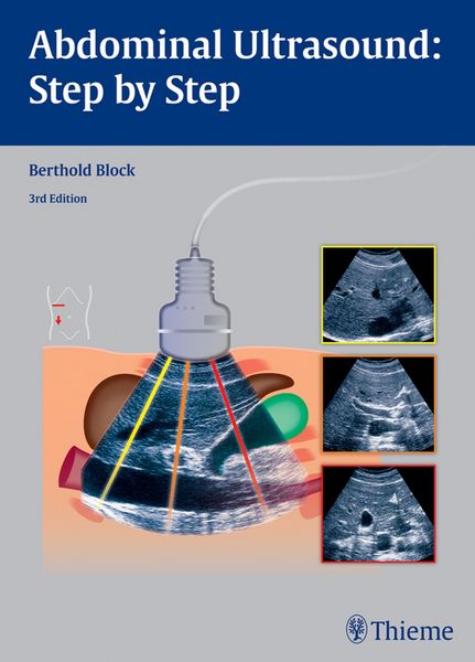 Produktbild: Abdominal Ultrasound: Step by Step