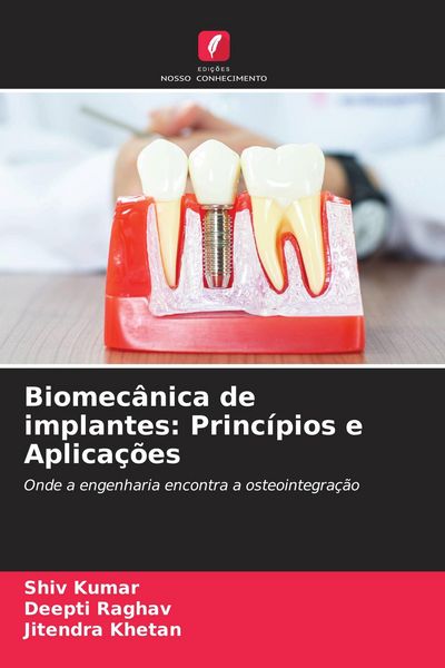Produktbild: Biomec&acirc;nica de implantes: Princ&iacute;pios e Aplica&ccedil;&otilde;es