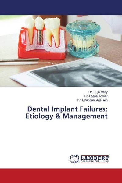 Produktbild: Dental Implant Failures: Etiology & Management