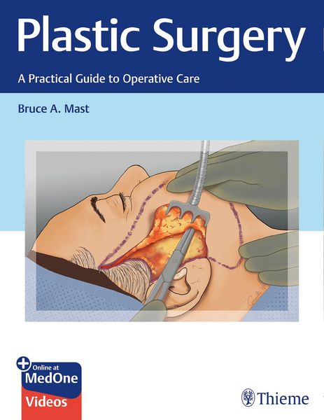 Produktbild: Plastic Surgery: A Practical Guide to Operative Care