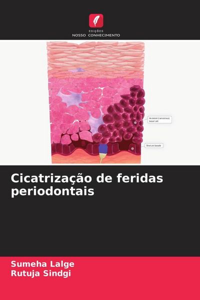 Produktbild: Cicatriza&ccedil;&atilde;o de feridas periodontais