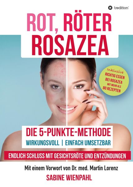 Produktbild: Rot R&ouml;ter Rosazea