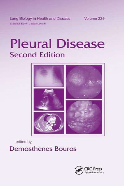 Produktbild: Pleural Disease