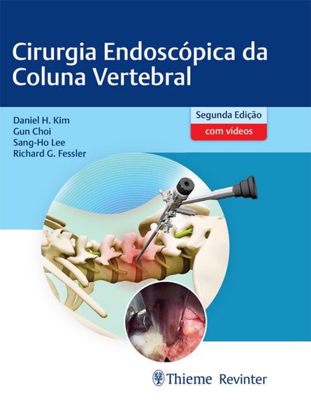 Produktbild: Cirurgia Endosc&oacute;pica da Coluna Vertebral