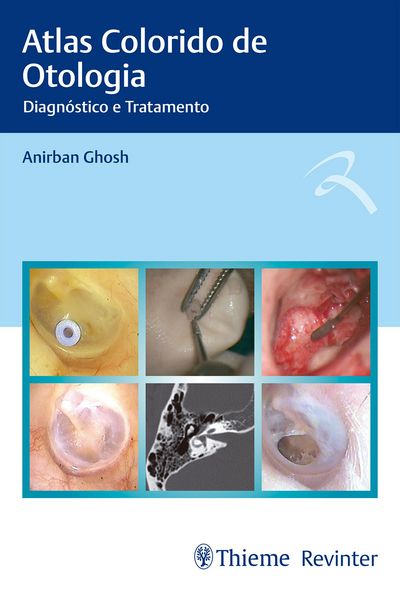 Produktbild: Atlas Colorido de Otologia