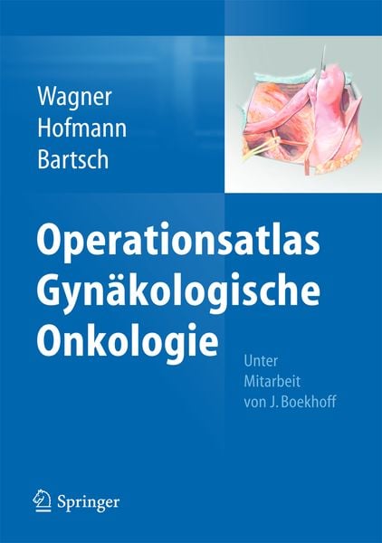 Produktbild: Operationsatlas Gyn&auml;kologische Onkologie