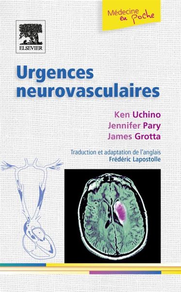 Produktbild: Urgences neurovasculaires