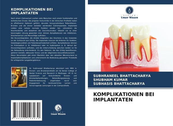 Komplikationen bei Implantaten, Taschenbuch von Subhraneel Bhattacharya , Shubham Kumar , Subhasis Bhattacharya, Verlag Unser Wissen, 9786208198930