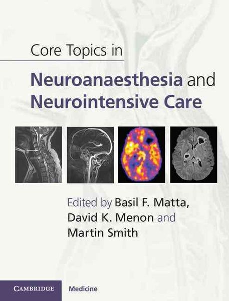 Produktbild: Core Topics in Neuroanaesthesia and Neurointensive Care