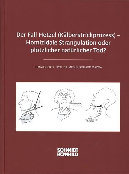Produktbild: Der Fall Hetzel (K&auml;lberstrickprozess) - Homizidale Strangulation oder pl&ouml;tzlicher nat&uuml;rlicher Tod?
