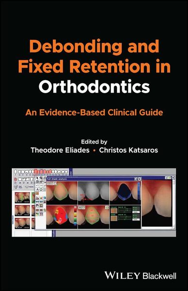 Produktbild: Debonding and Fixed Retention in Orthodontics