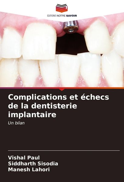 Produktbild: Complications et &eacute;checs de la dentisterie implantaire