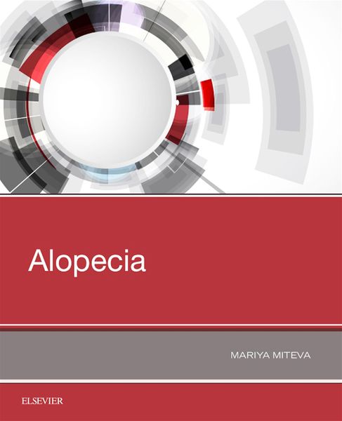 Produktbild: Alopecia
