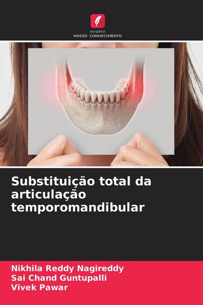 Produktbild: Substitui&ccedil;&atilde;o total da articula&ccedil;&atilde;o temporomandibular