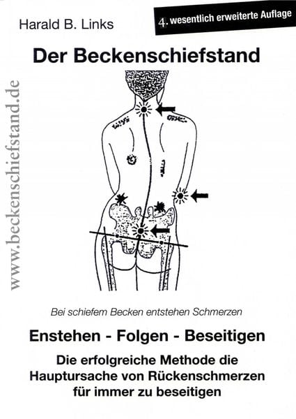 Produktbild: Der Beckenschiefstand