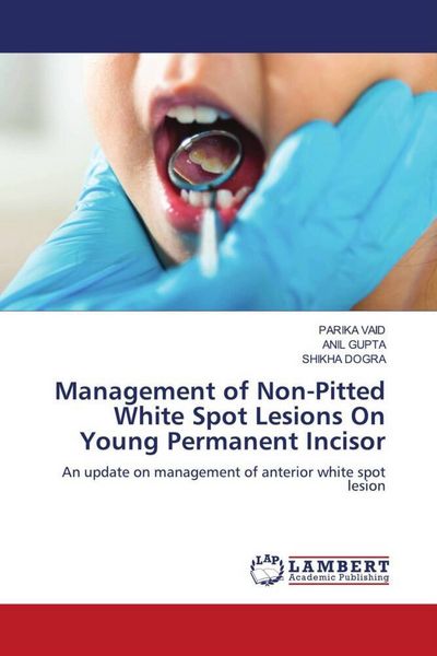 Produktbild: Management of Non-Pitted White Spot Lesions On Young Permanent Incisor